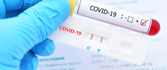 AUMENTAN LOS CASOS DE COVID-19 EN SANTO DOMINGO