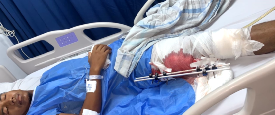 JHON NAZARENO REQUIERE REALIZARSE UNA  CIRUGÍA  PERO NO CUENTA CON LOS RECURSOS ECONÓMICOS