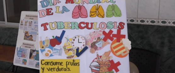 AUMENTAN LOS CASOS DE TUBERCULOSIS EN SANTO DOMINGO DE LOS TSÁCHILAS