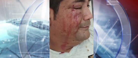 UN CONDUCTOR DE BUS URBANO FUE AGREDIDO POR UN SUPUESTO DIRIGENTE DE TRANSPORTE