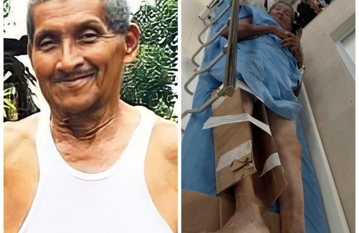 DEMETRIO BARRE SUFRIÓ UN ACCIDENTE Y DEBE SER INTERVENIDO QUIRÚRGICAMENTE