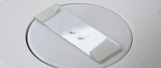 ADOLESCENTE MUERE EN SANTO DOMINGO; EL MSP INVESTIGA SI SE TRATÓ POR DENGUE