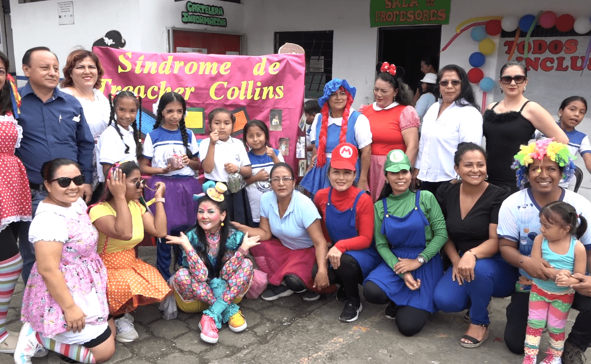 SE CONMEMORÓ EL DÍA INTERNACIONAL DEL SÍNDROME DE TREACHER COLLINS