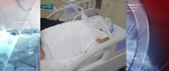 NO HAY RECURSOS PARA EL ÁREA DE QUEMADOS DEL HOSPITAL DR. GUSTAVO DOMÍNGUEZ