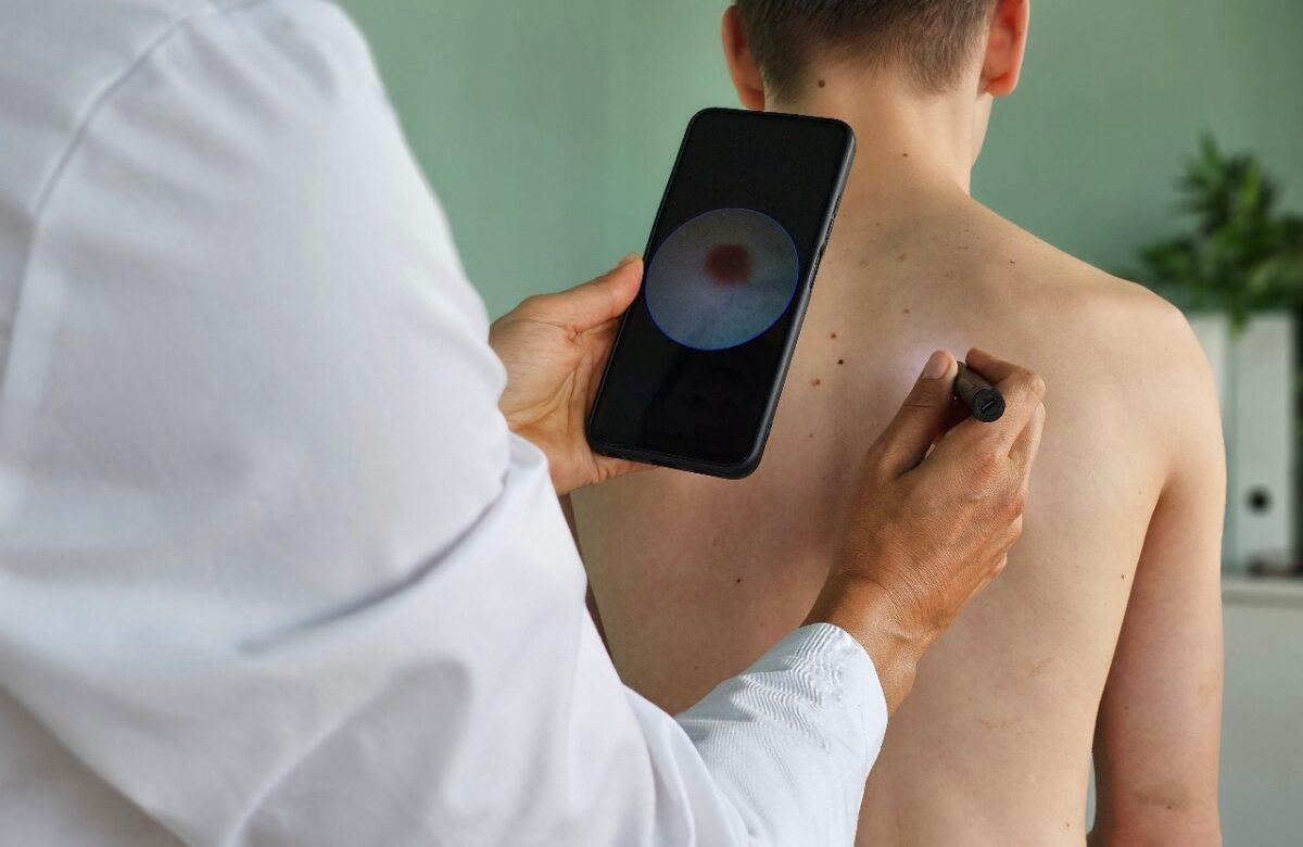 NUEVA TERAPIA CELULAR APROBADA PARA EL TRATAMIENTO DEL MELANOMA METASTÁSICO