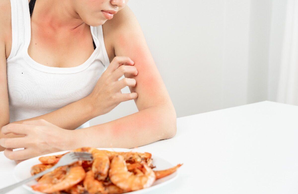 ALERGIA ALIMENTARIA VS. INTOLERANCIA: ¿CUÁL ES LA DIFERENCIA?