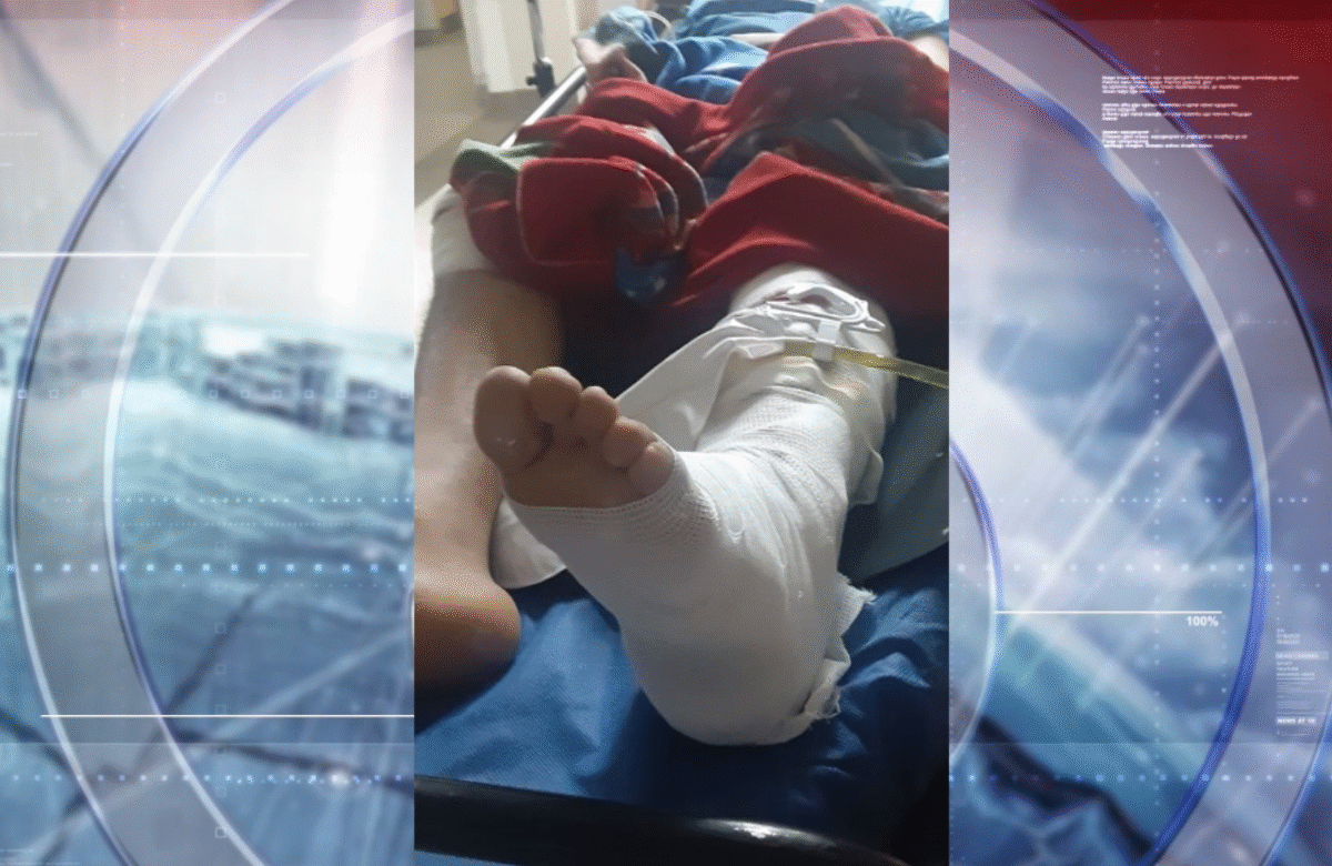 FAMILIARES PIDEN OPERAR URGENTE A JOVEN ACCIDENTADO EN EL CARMEN
